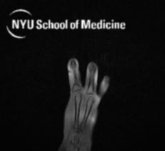 MRI "Glove" Provides New Look at Hand Anatomy