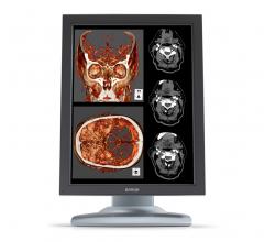 CT systems, Clinical trial/study, neuroimaging tests