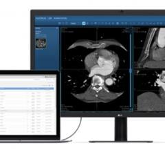 Children's Hospital Colorado to Manage Medical Images Via the Cloud With Nucleus.io Platform