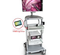 OmniVision Technologies Inc., a developer of advanced digital imaging solutions, and Diaspective Vision GmbH, developer of high quality hyperspectral and multispectral camera systems for medical applications, announced their partnership in the development of a new type of endoscopic camera, the Malyna system, which is based on proprietary multispectral imaging technology