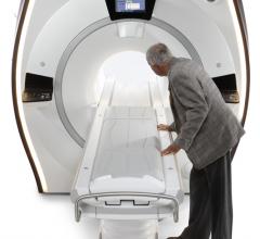 GE Healthcare Introduces GEM Radiation Therapy Open Head and Neck MR Coil Suite