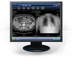 April 13, 2020 — Hyland Healthcare has launched PACSgear Enterprise – the latest version of the PACSgear server software, which supports the advanced capture and connectivity modules of the PACSgear platform. 
