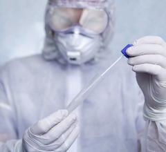 A PCR genetic test nasal swab being taken from a patient to test if they are infected with COVID-19. While used as the primary test to diagnose coronavirus, up to 20 percent of patients will test negative even eight days after infection. Getty Images