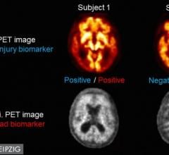 Single Dual Time-point PET Scan Identifies Dual Alzheimer's Biomarkers