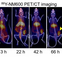 PET/CT imaging showing uptake and retention of 86Y-NM600 (imaging agent) in immunocompetent mice bearing prostate tumors. PET imaging data was employed to estimate tumor dosimetry and prescribe an immunomodulatory 90Y-NM600 (therapy agent) injected activity. Image courtesy of R Hernandez et al., University of Wisconsin-Madison, WI.