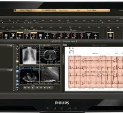 IntelliSpace Cardiovascular, Philips, CVIS, cardiac PACS