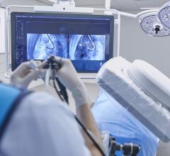 Philips Azurion Lung Edition supports high precision diagnosis and minimally invasive therapy in one room