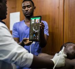 Philips Partners With PURE on Tele-Ultrasound Program for Physicians in Rwanda