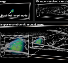 Researchers at the University of Illinois Urbana Champaign have developed a dual-modality imaging technique that not only delivers comprehensive diagnostic information but also provides a cost-effective solution for healthcare providers 
