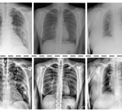 Medical professionals around the world have been feeding lung X-rays into a database since the beginning of the pandemic