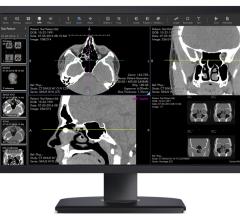 Ambra Health recently launched the Ambra ProViewer, which allows for mobile access for quick reads, and full diagnostic teleradiology capabilities from any device with a major web browser.