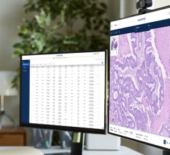 Digital and computational pathology solution provider Proscia has announced that Pramana, Inc. is now a Proscia Ready partner, in an alliance the companies report paves the way to advance cancer research and diagnosis with enriched, high-quality DICOM images.