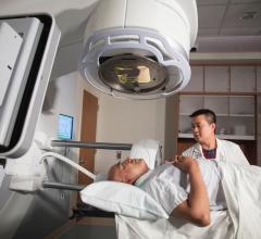 New Guideline for Prostate Cancer Supports Shortened Radiation Therapy