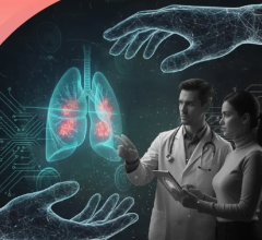 Qure.ai, Microsoft to Collaborate on Lung Cancer Detection and Management Suite in the U.S.