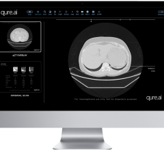 Qure.ai announced that its solutions were awarded the CE Class IIb certification for medical devices under the European Union Medical Device Regulation (Regulation (EU) 2017/745) (EU-MDR). 