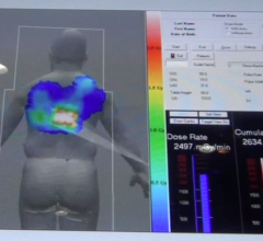 radiation therapy, microRNA, miR-34, cell survival, UCLA study