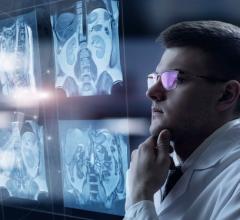 Harvey L. Neiman Health Policy Institute Study: Radiology Subspecialization Continues to Grow Due to Consolidation, Practice Closure