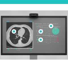 RevealDx Receives MDR Certification for RevealAI-Lung