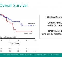 Overall survival of metastatic patients with SABR presented at ASTRO 2018. #ASTRO #ASTRO18 #ASTRO2018