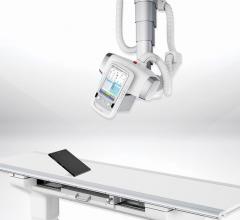 Samsung Adds S-Vue 3.02 Imaging Engine to GC85A Digital X-ray for Lower Dose