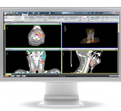 Elekta's Monaco 5.0 Consolidates Treatment Planning Capabilities in One System