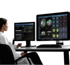 Agfa impax agility pacs rsna 2013 ris 