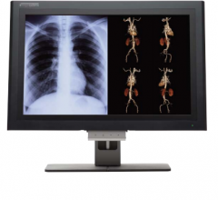 rsna 2013 flat panel displays canvys image systems xled
