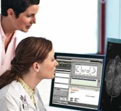 women's health rsna 2013 vue pacs carestream digital breast tomosynthesis dbt