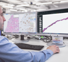 AI-based cancer assessment tools are poised to help pathologists improve speed and accuracy of cancer diagnostics, ultimately leading to better patient care