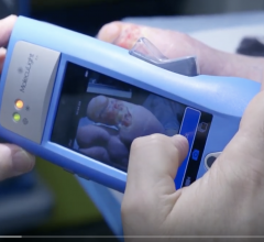 MolecuLight’s i:X procedure in wound care