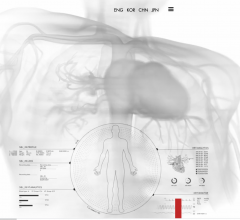 The agreement is intended to integrate Qure.ai’s proprietary technology for chest x-ray screening and head CT triage in the Nanox.Cloud to improve imaging solutions and increase patient access to medical imaging world-wide