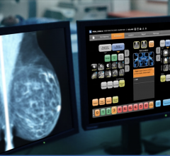 #COVID19 #Coronavirus #2019nCoV #Wuhanvirus #SARScov2 Ikonopedia is providing web-based training and installation to help customer base leverage efficiency gains to handle anticipated patient volumes post COVID-19