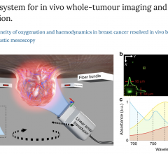 a Schematic of the system. The entire solid tumour is illuminated from four sides by a four-arm fibre bundle. A cylindrically focused linear array is designed to detect optoacoustic signals from the tumour. In vivo imaging is performed in conical scanning geometry by controlling the rotation and translation stages. The sensing part of the transducer array and the tumour are submerged in water to provide acoustic coupling. b Maximum intensity projections of the optoacoustic reconstruction of a phantom of pol