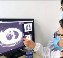 Software enables faster and more automated diagnosis of lung diseases including COVID-19