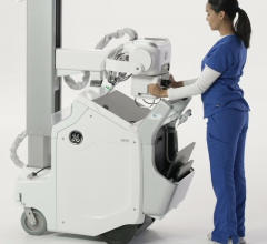 First-of-its-kind, power-assisted Free Motion telescoping column reduces lift force by up to 70 percent to significantly reduce musculoskeletal stress and strain injuries that may occur over the course of an X-ray technologist’s career