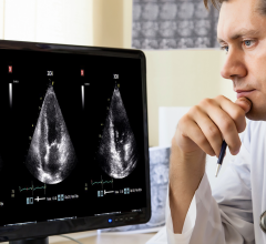 DiA Imaging Analysis, a leading provider of advanced AI-based software for ultrasound analysis, was featured in a recent study presented by a team of cardiac physicians from Mount Sinai's Icahn School of Medicine at the American Heart Association meeting. 