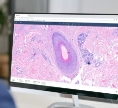 Proscia, a leader in digital and computational pathology solutions, announced a multi-year OEM agreement with Siemens Healthineers. Under the agreement, Siemens Healthineers will expand its Enterprise Imaging offering towards the global digital pathology market using Proscia’s Concentriq Dx platform.