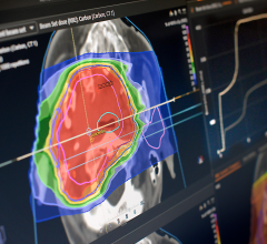 GE Healthcare is proud to announce that it has entered into an agreement to collaborate with RaySearch Laboratories AB, a leading radiation oncology software provider, to develop a new radiation therapy simulation and treatment planning workflow solution, designed to simplify how radiation will be targeted to shrink a tumor.