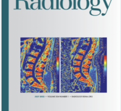 One of the top-cited journals in the field, Radiology publishes cutting edge and impactful imaging research articles in radiology and medical imaging 