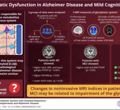 Researchers reveal new noninvasive MRI measures of the glymphatic system function that could be used to track Alzheimer disease progression 