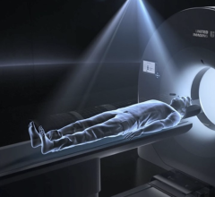 With uMI Panorama, United Imaging Continues to Push the Envelope on Whole-Body System Performance
