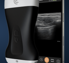 Clarius specialized wireless ultrasound scanners now available on national group purchasing agreement to over 4,350 Health Systems and Hospitals and 300,000 other healthcare providers.   