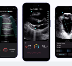Survey offers insights into point-of-care ultrasound expansion into hospitals and primary care, what’s holding adoption back, and the impact of artificial intelligence on medical imaging