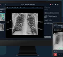 This reinforces Qure.ai's position as a pioneer in the field of AI-powered advancements for plain film radiography and medical imaging