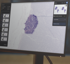 Paige, a global leader in end-to-end digital pathology solutions and clinical AI applications, today announced the release of a groundbreaking product developed from Paige’s Pathology Foundation Model, Virchow. 
