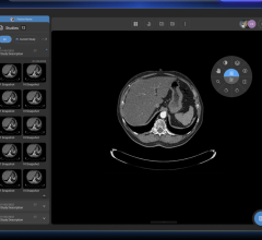 RamSoft’s robust solutions provide Premier with unmatched speed and reliability for reading and processing images for its fast-growing teleradiology operations