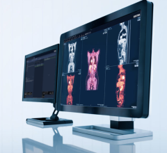  International medical imaging IT and cybersecurity company Sectra’s enterprise imaging solution has been selected by the university hospital Hospital Universidad del Norte, in Colombia