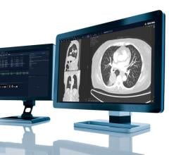 International medical imaging IT and cybersecurity company Sectra has signed a contract for radiology imaging with an NHS consortium in Surrey and Sussex in the UK. 