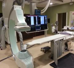 Shimadzu, Trinias C-12, First Coast Heart, angiography system, cath lab