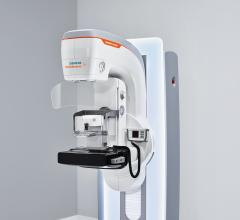 Siemens Healthineers Introduces Mammomat Revelation Mammography System for Improved Biopsy Workflow